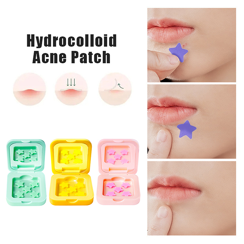 1 caixa hidrocolóide acne reme - Glass Break Detector avaliação e preço